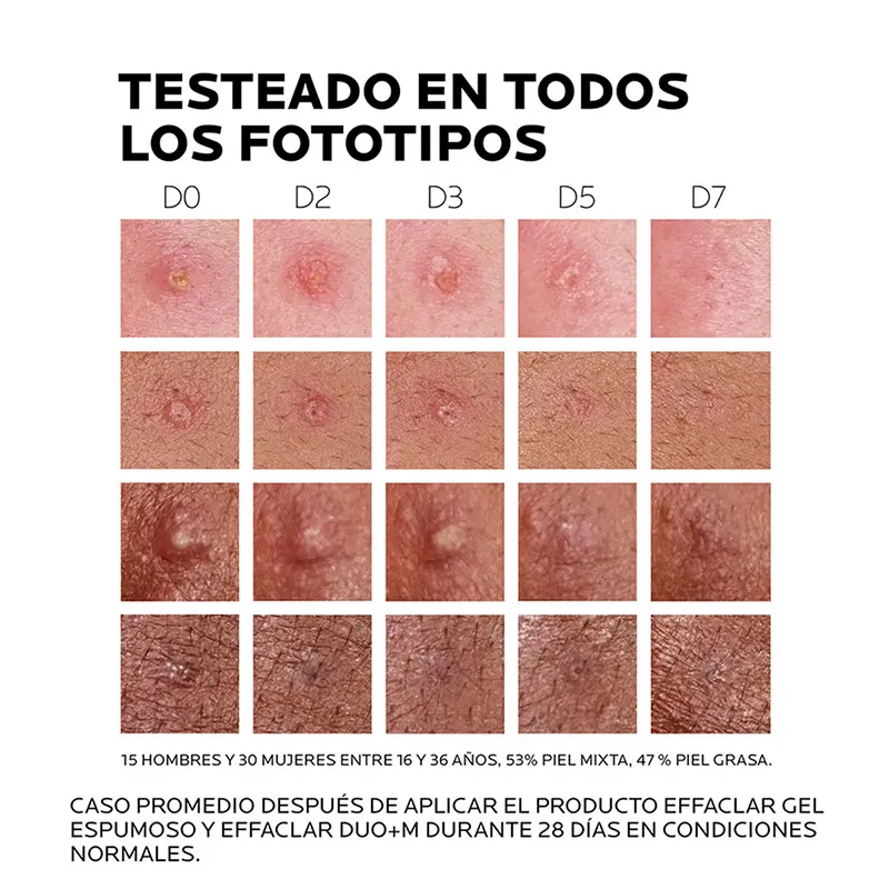 Image miniatura de 3337875863377-effaclar-duo--m-4.jpg-61488.webp